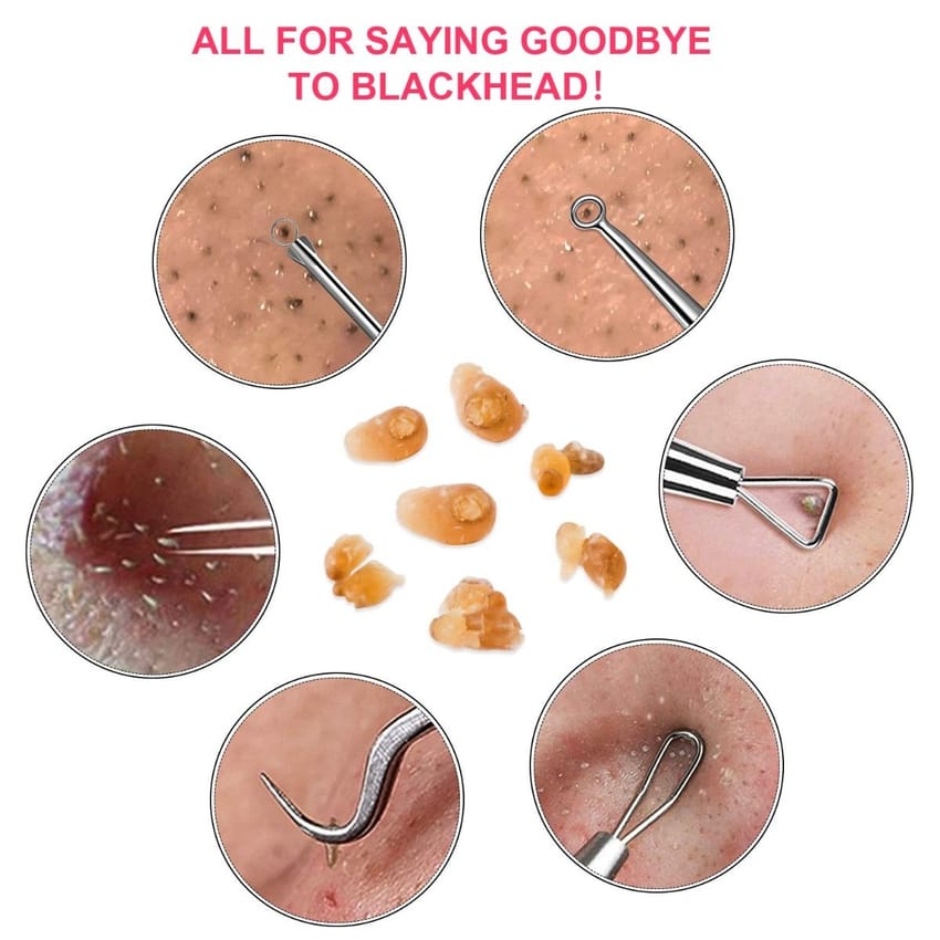 Blackhead Remover Pimple Popper Tool 10 pieces product thumbnail 3