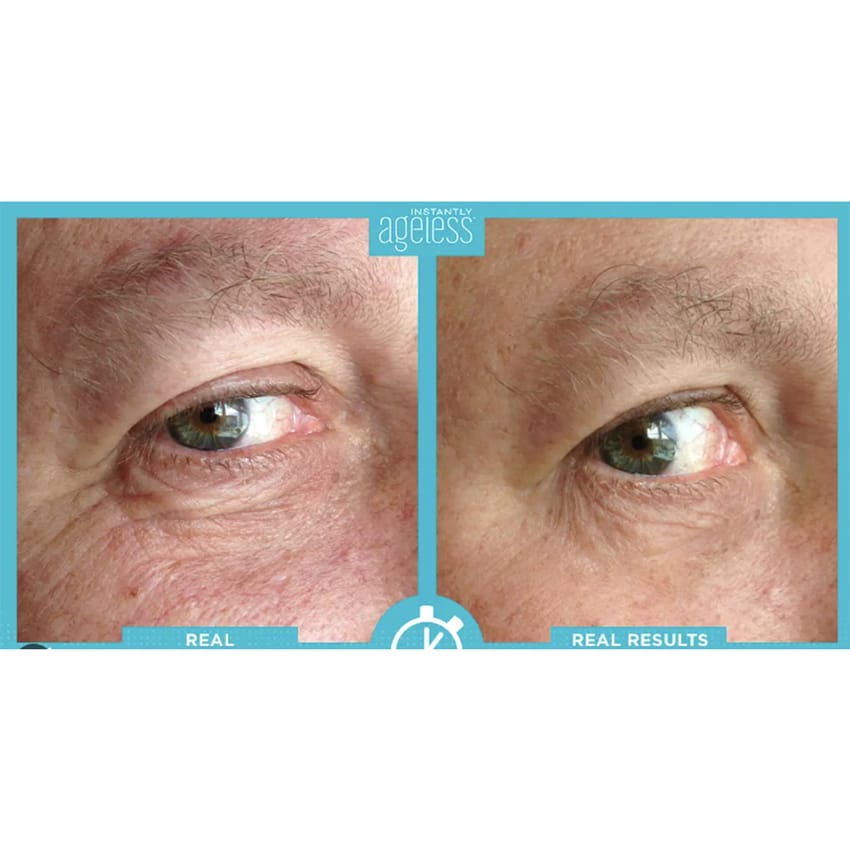 Instantly Ageless Facelift Count 1 piece product thumbnail 4